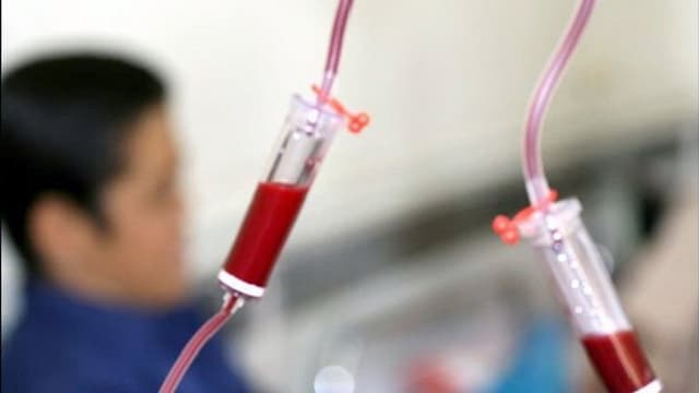ایران نهمین کشور جهان از نظر شیوع هموفیلی